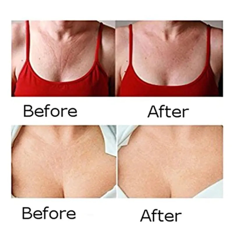 Face, Neck & Chest Wrinkle Removal Patches