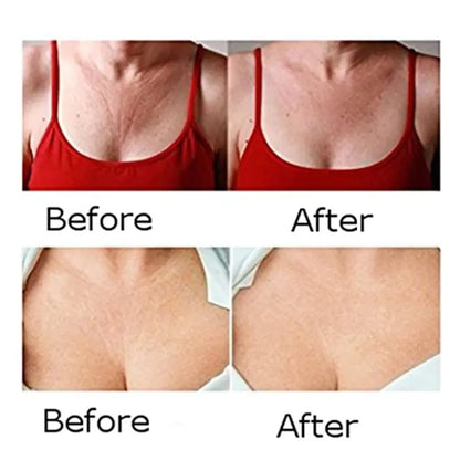 Face, Neck & Chest Wrinkle Removal Patches